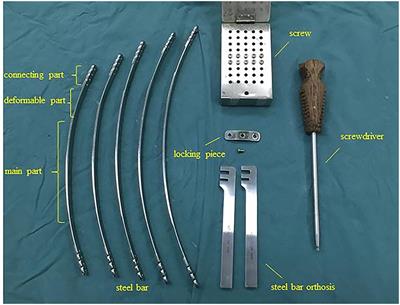 Comparison of Outcomes Between Anti-Nuss Operation and Modified Anti-Nuss Operation Using a Flexible Plate for Correcting Pectus Carinatum: A Retrospective Study